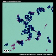 staphylococcus microscopy